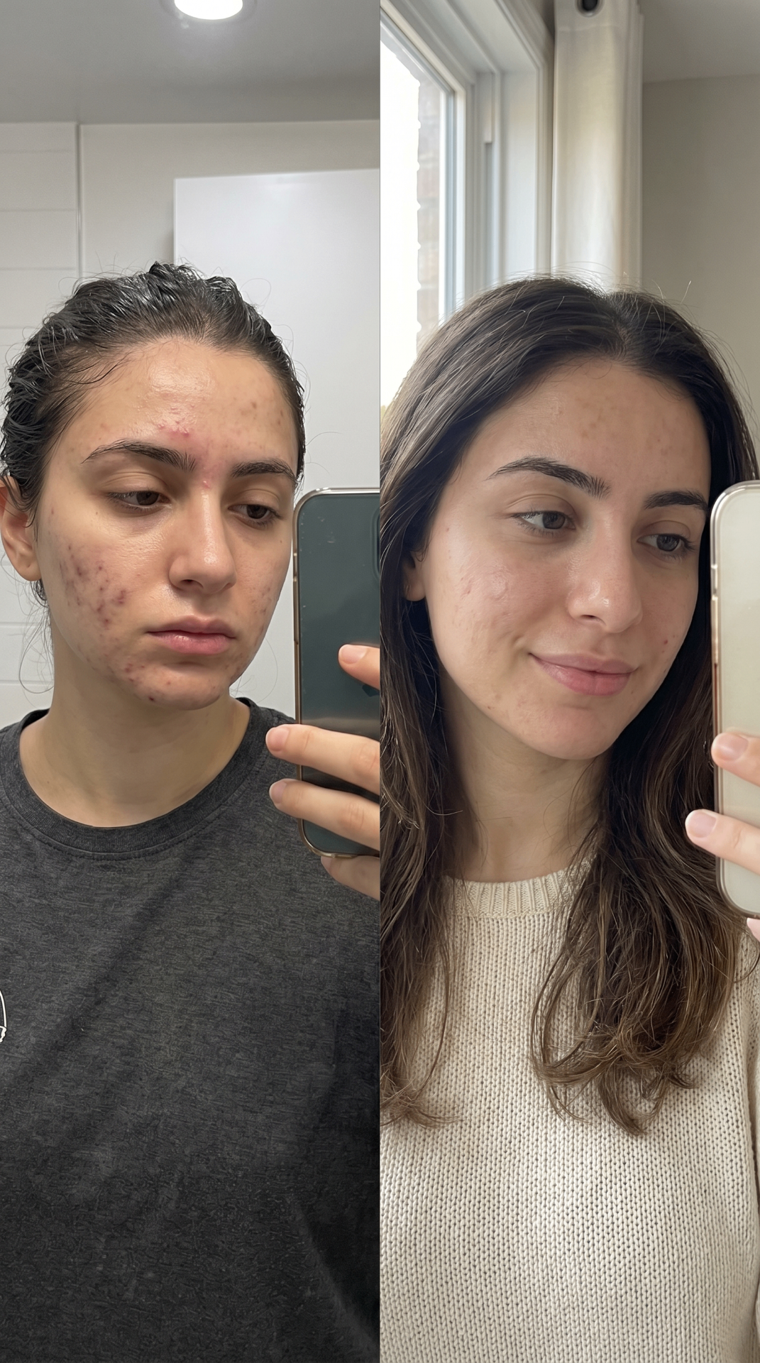 Habibti 1 transformation